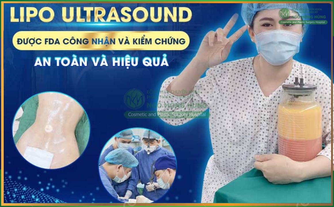 Công nghệ hút mỡ Lipo Ultrasound