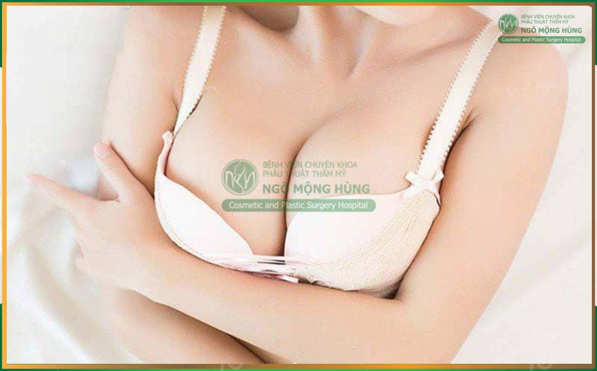 tư vấn nâng ngực miễn phí