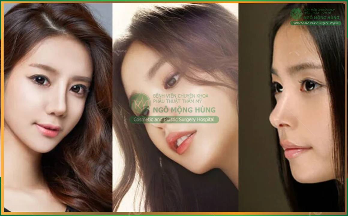 Combo nâng mũi và cắt mí