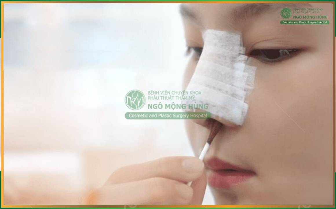 Kiêng ăn gì sau khi nâng mũi?