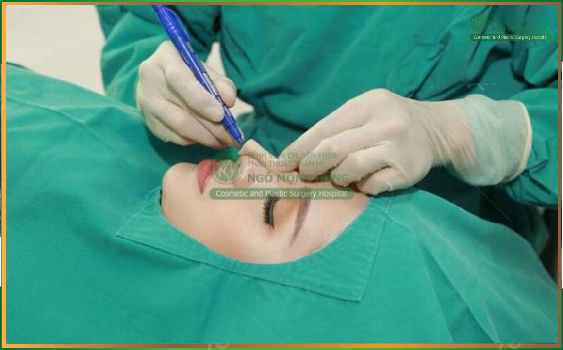 Bác sĩ nâng mũi mát tay nhất Sài Gòn