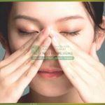 Thu nhỏ đầu mũi không phẫu thuật có hiệu quả không?