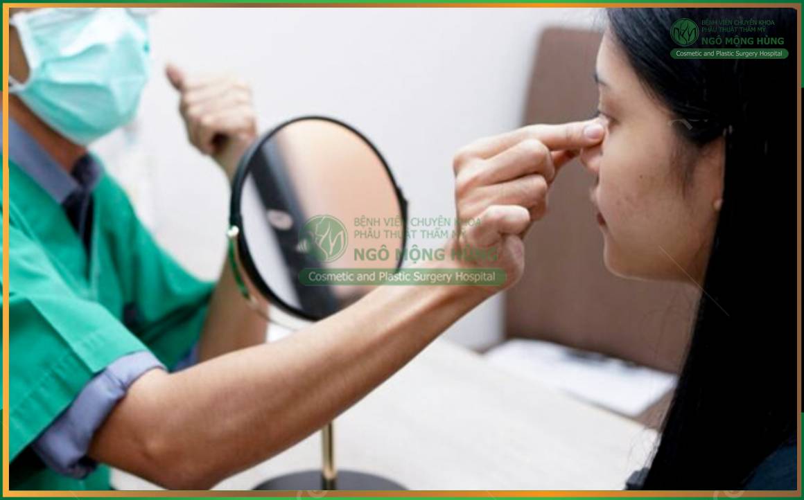 Nâng mũi S Line giá bao nhiêu?