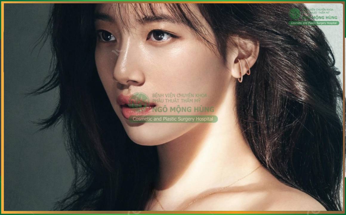 Nâng mũi kín Preservation